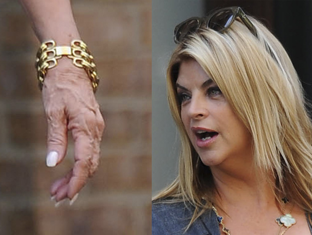 Kirstie Alley zrobi sobie LIFTING DŁONI?!