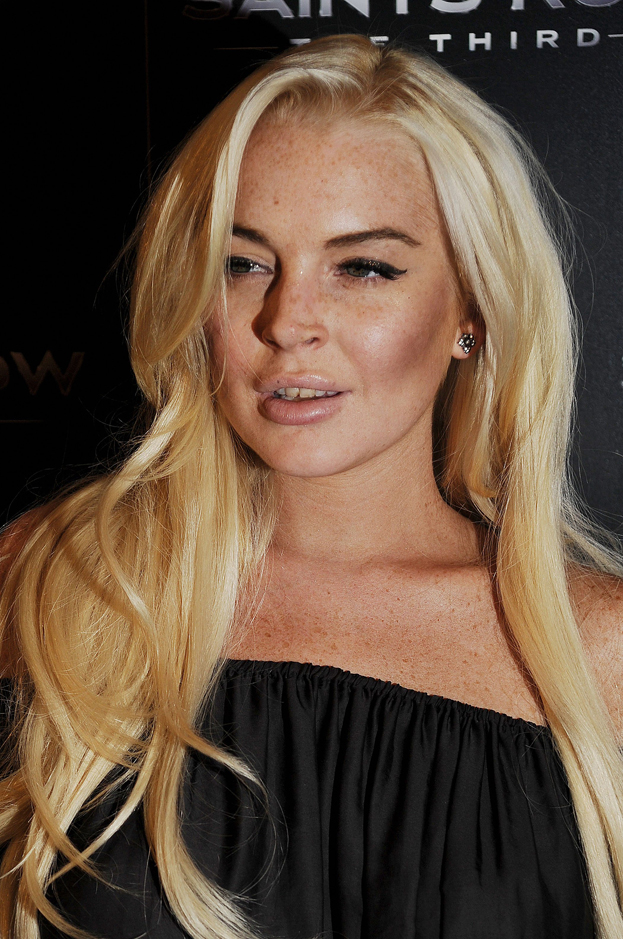 Lindsay chwali się nowymi zębami!